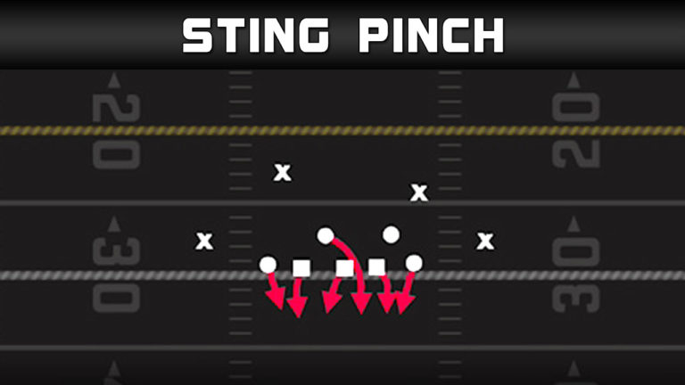 3-4 Over – Sting Pinch