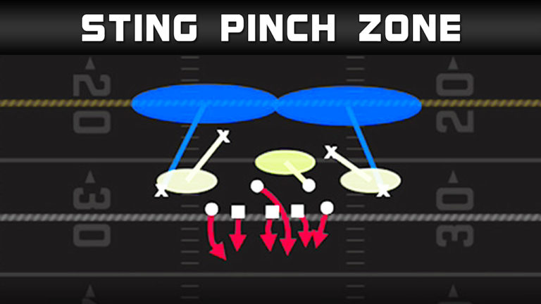 3-4 Over – Sting Pinch Zone